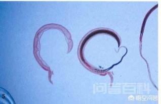 人体的寄生虫是从哪里来的? 寄生虫哪里来的这个问题让我想起了鲁迅