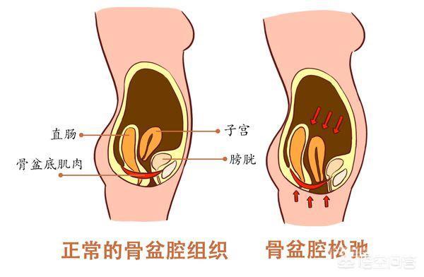 哪些人适合盆底肌锻炼? 我从事健身行业13年了
