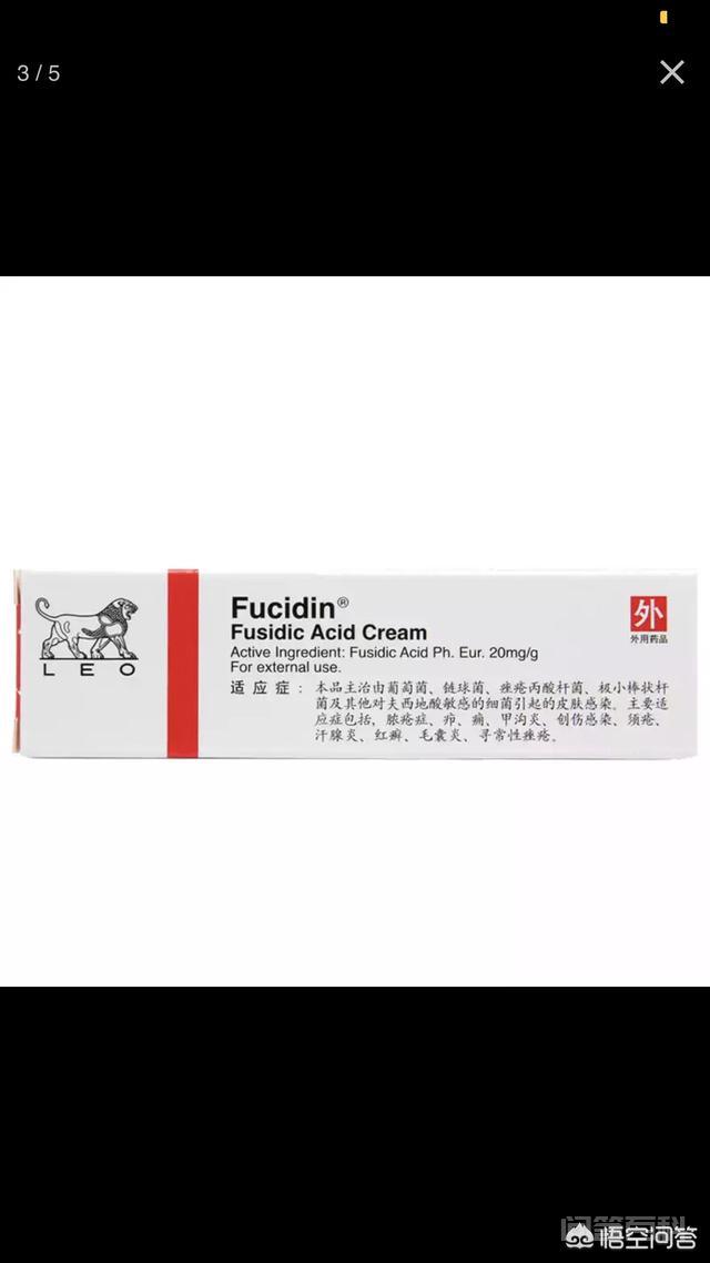 脸上长满痘痘怎么办? 下面我来给大家分享一下我治疗痘痘的心