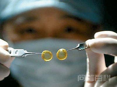 现代高科技产品有哪些 人造生物角膜临床试验