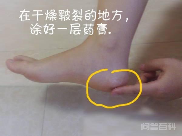 回来现在又干裂