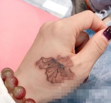 经典整形对比照>>>去纹身前后对比图>>>激光去纹身案例 纹身神奇消失不见啦 项目:激光去纹身