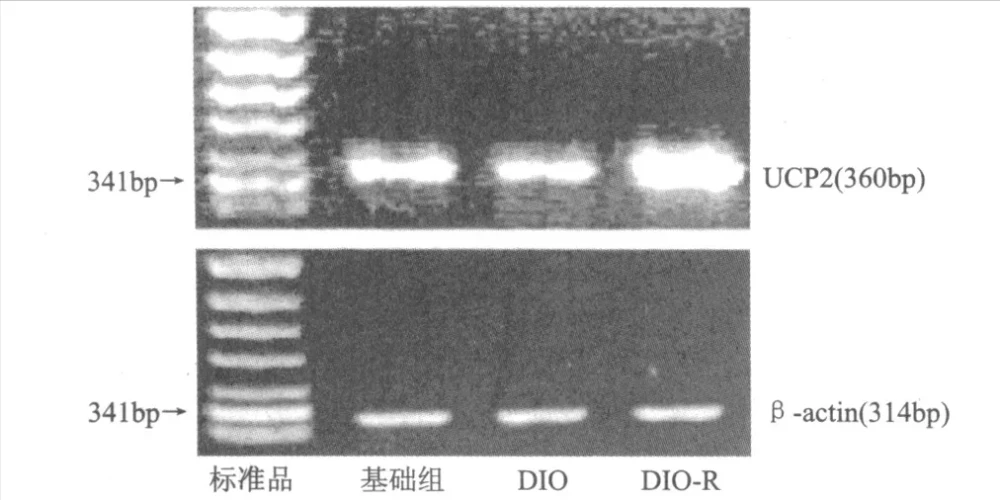 生酮饮食可以通过增加线粒体解偶联蛋白