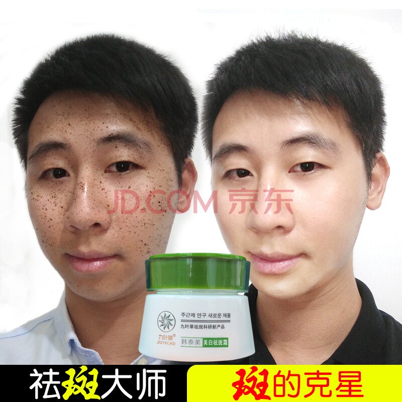 2019淡斑精油排行榜10强,想淡化色斑就选这些产品! 改善皮肤的问题状况