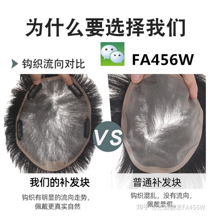 揭秘:假发片好用吗多少钱 假发片好用吗多少钱您所在的城市地图一