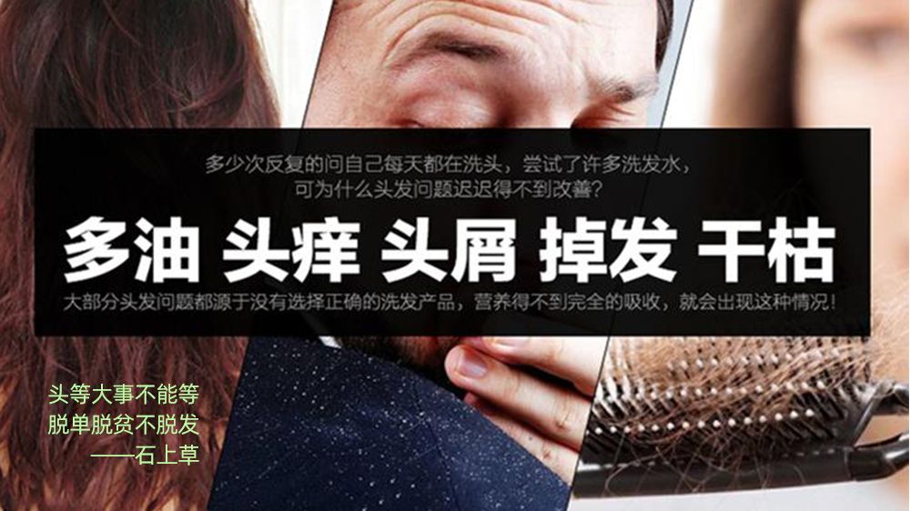 防脱洗发水有哪些?全网最硬核的防脱洗发水没有之一 介绍防脱洗发水的种类及功效