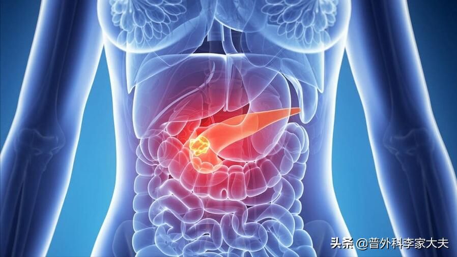 文章目录：